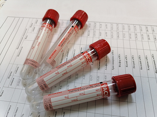 probirka stat 20